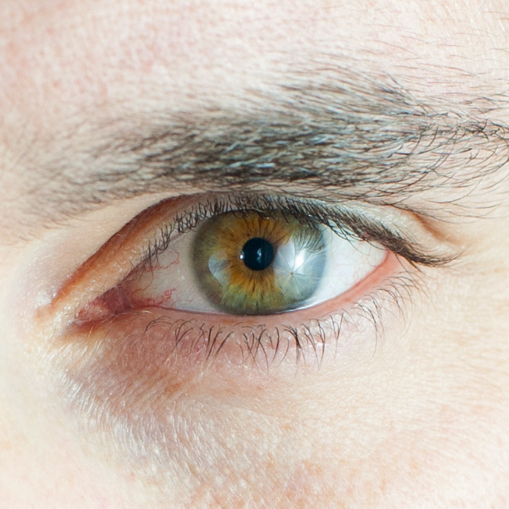 Diagnóstico y protocolos de alteraciones capilares estéticas - contenido online